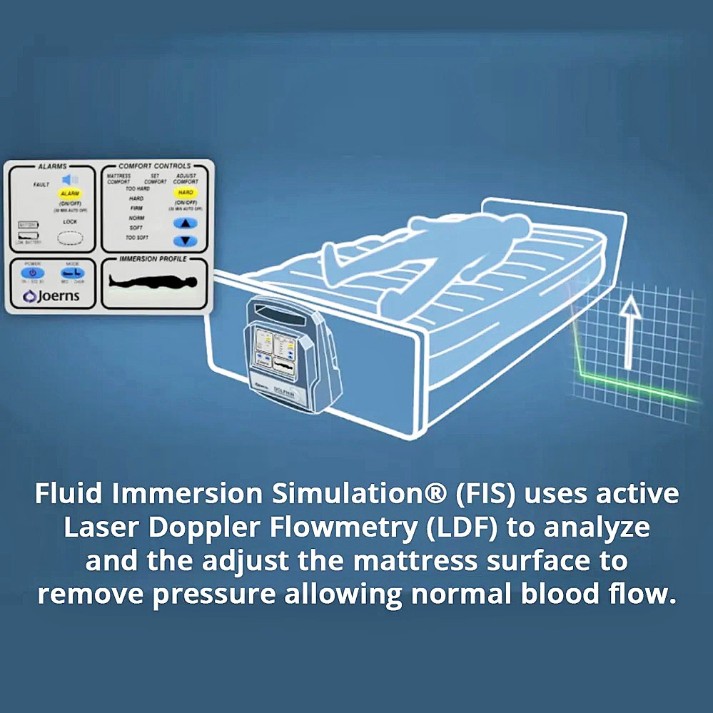 Dolphin® Fluid Immersion Simulation® Advanced Therapy Surfaces - Dolphin® FIS System - Laser Doppler Flowmetry (LFD) Analysis Technology - Model DLPH - Homecare